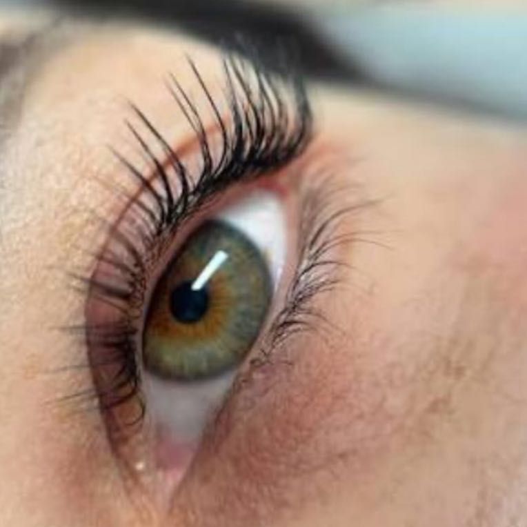 Koci lifting - efekt przed i po zabiegu